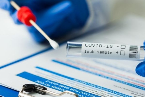 centrallab-arthra-moriakos-elenchos-pcr-gia-ton-sars-cov-2