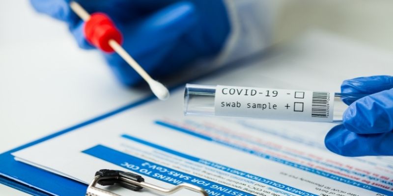 centrallab-arthra-moriakos-elenchos-pcr-gia-ton-sars-cov-2