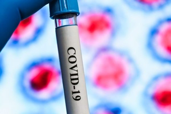 centralllab-arthra-anosologikos-elenchos-gia-ton-prosdiorismo-ton-antisomaton-enanti-tou-sars-cov-2