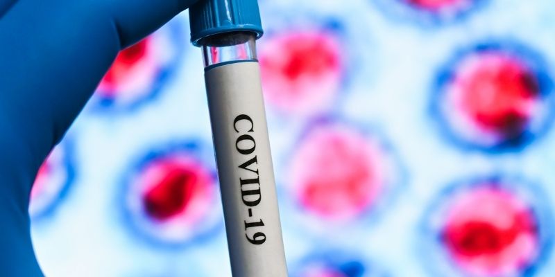 centralllab-arthra-anosologikos-elenchos-gia-ton-prosdiorismo-ton-antisomaton-enanti-tou-sars-cov-2